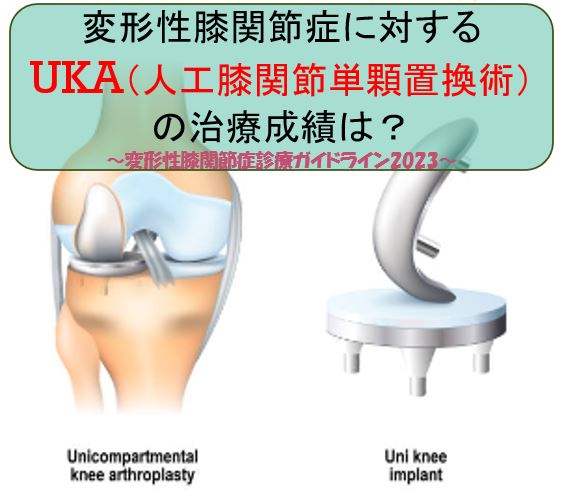 変形性膝関節症に対するUKA（人工膝関節単顆置換術）の治療成績 | 運動 